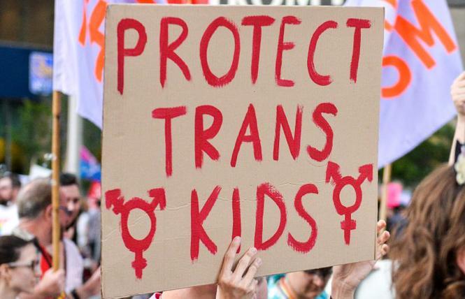 Bay Area Reporter :: LGBTQ Agenda: Nearly 60,000 adolescents would be harmed by anti-trans laws in US, report says - Vimarsana News